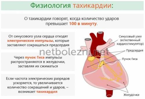 Какие лекарства пить при тахикардии