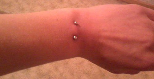 Консультации онлайн. Из какого пальца брать кровь на сахар для глюкометра