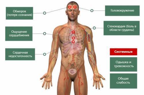 Учащенное сердцебиение после еды причины - Всё о сердце