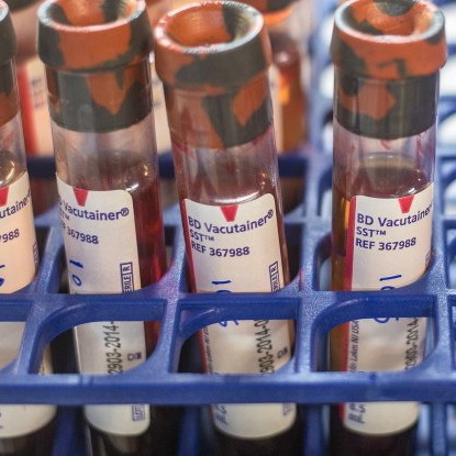 Процесс обновления крови особенности женского и мужского организма. - Энциклопедия Здоровья