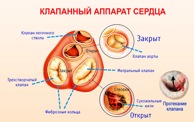 Регургитация митрального клапана