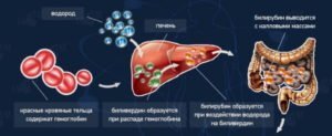 Как понизить билирубин в крови: лекарства и народные рецепты