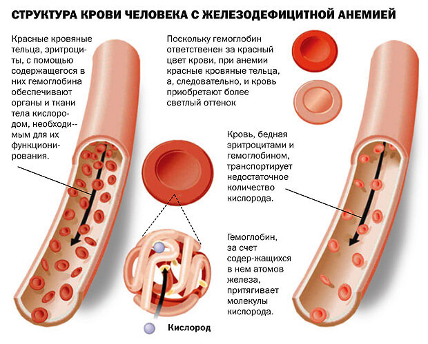 Гемоглобин у женщин – норма, повышенный и низкий гемоглобин у женщин