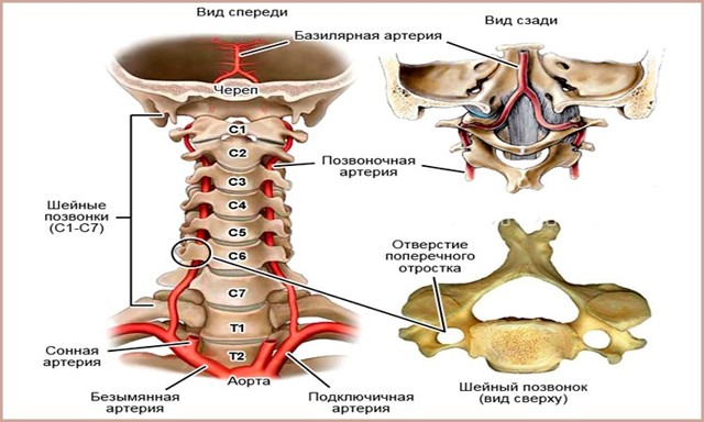 Асимметрия v4 сегментов позвоночных артерий d s. Можно ли вылечить синдром позвоночной артерии при остеохондрозе
