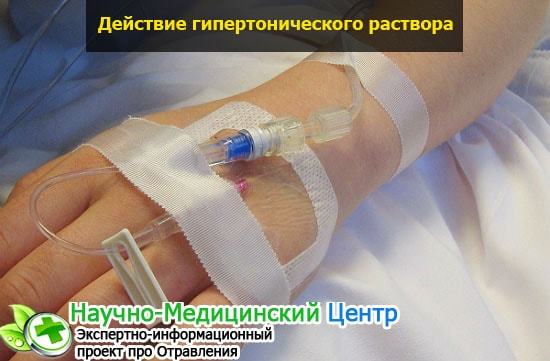 Капельница с глюкозой — для чего? Инструкция по применению, польза физраствора с глюкозой