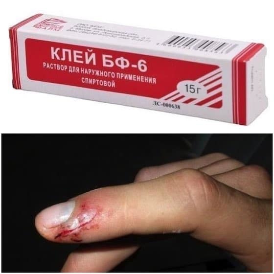 Как быстро остановить кровь при порезе, в том числе глубоком, первая помощь, медицинский клей для ран и другие средства