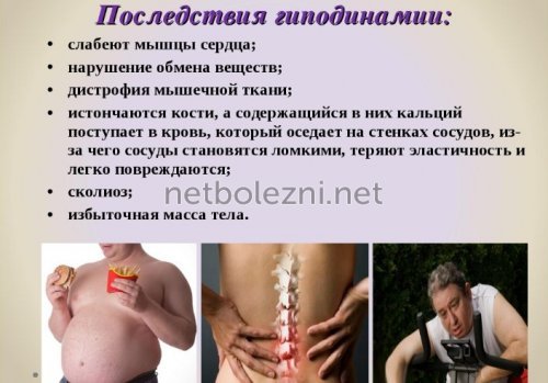 Предпосылки инсульта головного мозга у женщин - как избежать инсульта у женщин