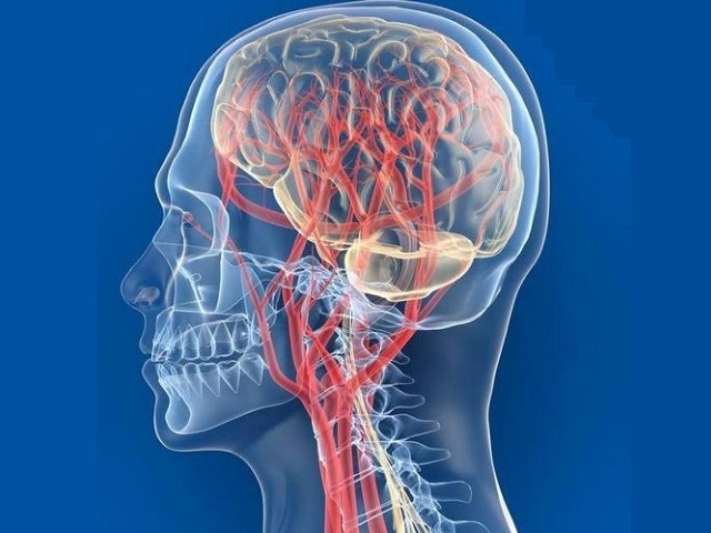 Лейкоэнцефалопатия головного мозга что это такое