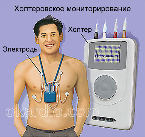 Холтер что это такое — Сердце