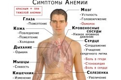 Признаки заболеваний крови