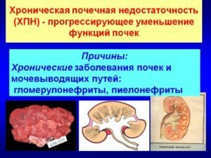 Креатинин при почечной недостаточности