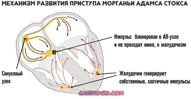 Пульс 95 в покое причины - Все про гипертонию