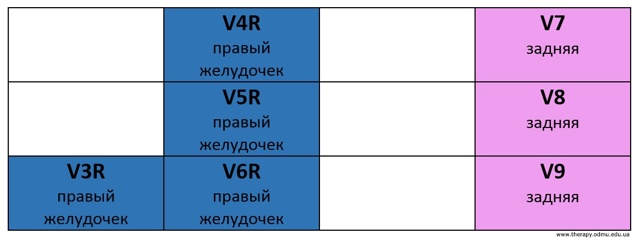 Стандартные отведения от конечностей - 1,2,3