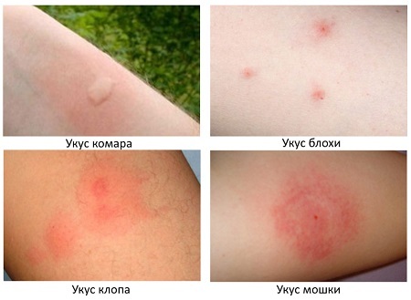 Красные пятна на теле у взрослого - появились красные пятнышки на лице