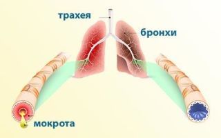 Мокрота белого цвета при кашле