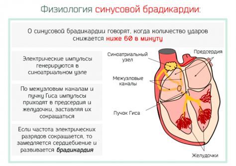 Брадикардия сердца: что это такое и как лечить, симптомы, причины
