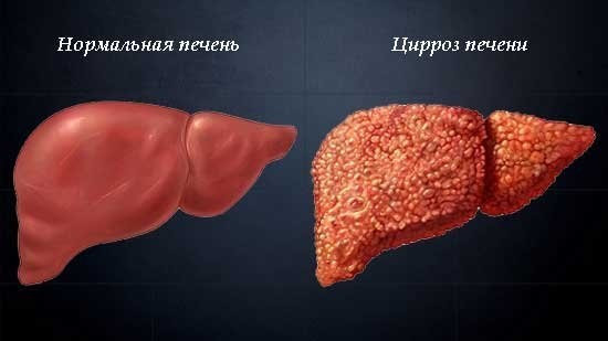АЧТВ: расшифровка, показания к анализу