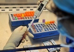 Анализ крови на билирубин - что это такое, как обозначается