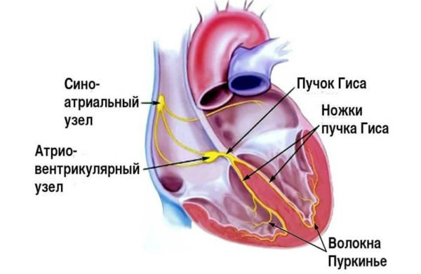 Чем опасна блокада ножек пучка гиса и как ее лечить