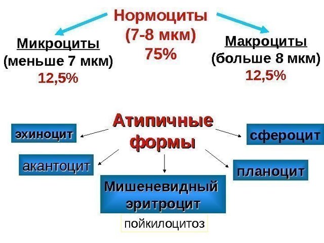 Анизоцитоз в общем анализе крови: что это, виды, причины