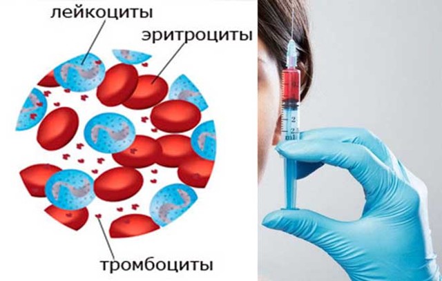 Характеристика клеток крови, Эритроциты (красные клетки крови), Лейкоциты (белые клетки крови), Тромбоциты (кровяные пластинки) - Биохимия человека