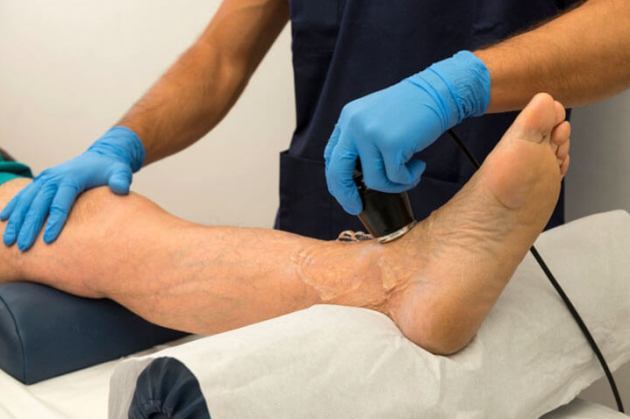 Трофические язвы нижних конечностей: виды, симптомы, лечение