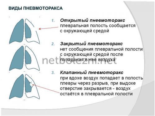 Болит и колит сердце при вдохе: причины, что делать?