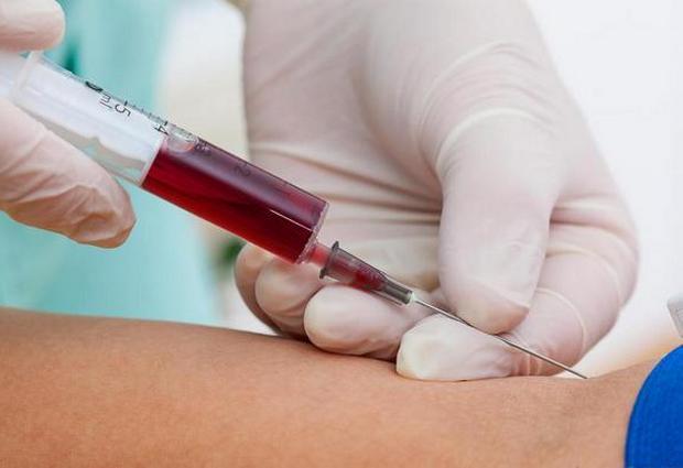 Щелочная фосфатаза в крови понижена у женщин - причины