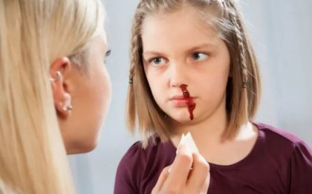 Первая помощь при кровотечении из носа: как правильно оказать медицинскую помощь (алгоритм) при сильном кровотечении, что нужно делать чтобы из носа пошла кровь без боли