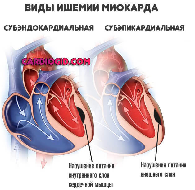 Милдронат - применение, инструкция, показания