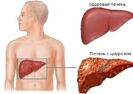 Аланин трансаминазы в крови – что это такое