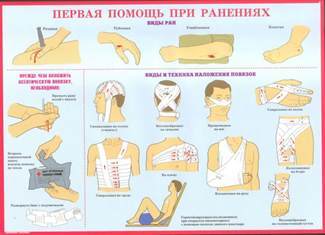 Кровотечі і перша допомога при них