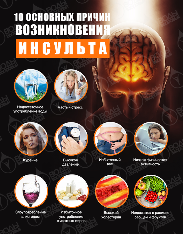 От чего бывает инсульт и почему он происходит