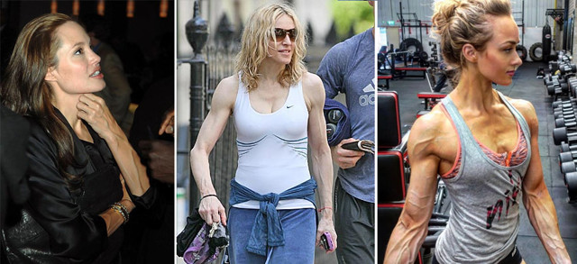 Почему видны вены на руках и как их убрать?