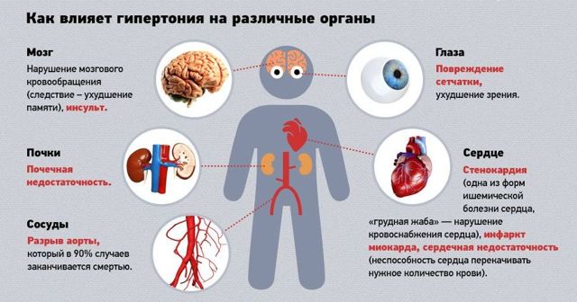 Высокое давление – причины, признаки, симптомы. Что делать при повышенном давлении?