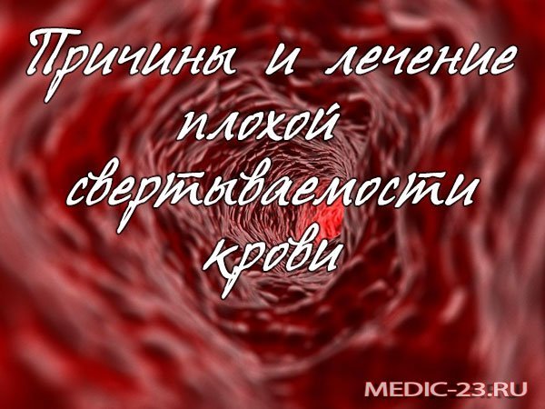 Плохо сворачивается кровь – что делать
