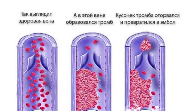 Народные рецепты: Горец почечуйный