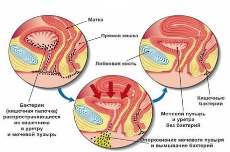 Норма СОЭ в крови у мужчин, женщин и детей по возрасту. Таблица. СОЭ выше нормы