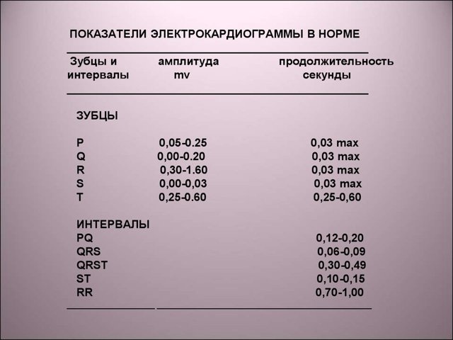 Расшифровка ЭКГ — норма и отклонения, выявление патологий