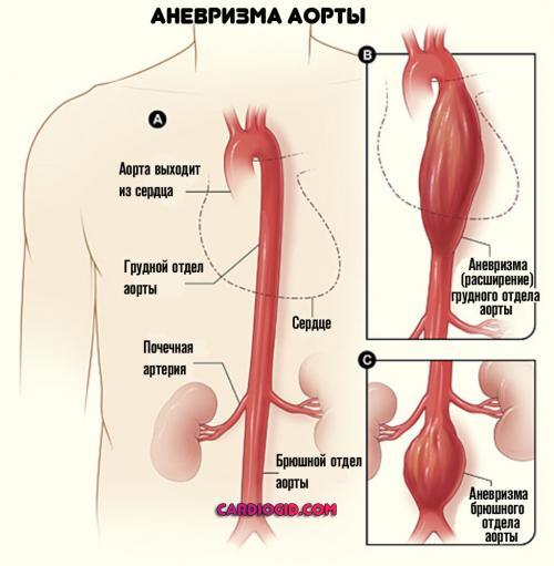 Ноющая боль в области сердца: причины и лечение