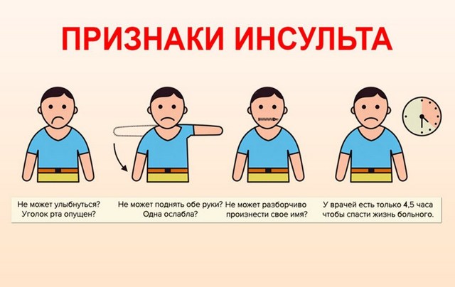 Микроинсульт – симптомы и последствия, признаки, лечение, или Берегите здоровье смолоду