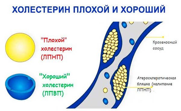 Диета при атеросклерозе сосудов нижних конечностей