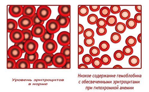 Анизоцитоз в общем анализе крови: что это, виды, причины