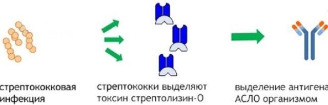 Антистрептолизин о повышен: причины, симптомы, лечение