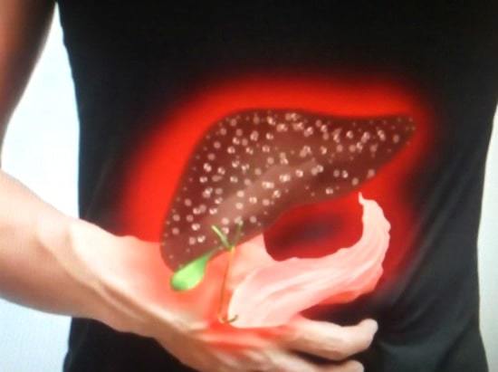 Повышенный билирубин – причины и симптомы билирубина, диагностика, лечение и профилактика