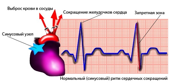 Синусовый ритм: что это в заключении ЭКГ, расшифровка и норма