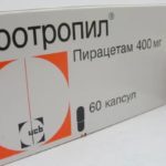 От чего бывает шум в голове