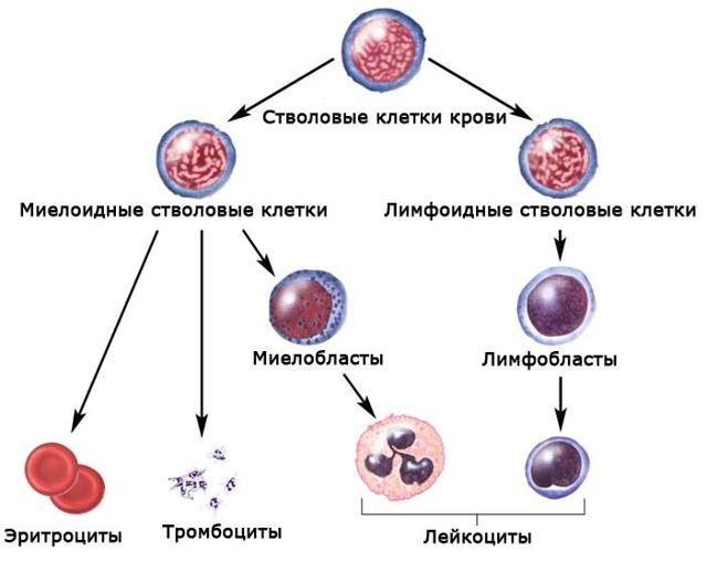 Особенности протекания и лечения миелоидного лейкоза