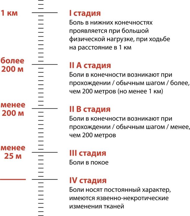 Облитерирующий атеросклероз сосудов нижних конечностей – симптомы и лечение