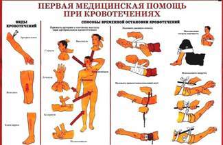 Кровотечі і перша допомога при них